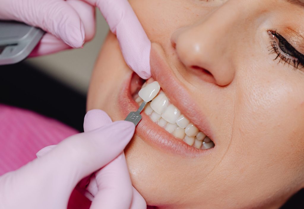 Estetica dentale a San Lazzaro di Savena